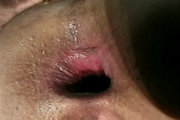 Anus éclatés : ça fait du bien par ou ça passe